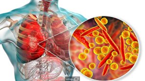 توصیه‌های بهداشت مرکز گلستان برای پیشگیری از ابتلا به بیماری‌های واگیر تنفسی